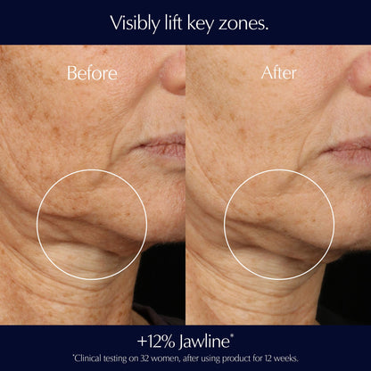 Estee Lauder Perfectionist Pro - LuxaMart